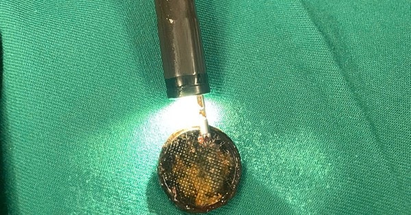 Hình ảnh pin cúc áo được các bác sĩ Hình ảnh pin cúc áo được các bác sĩ