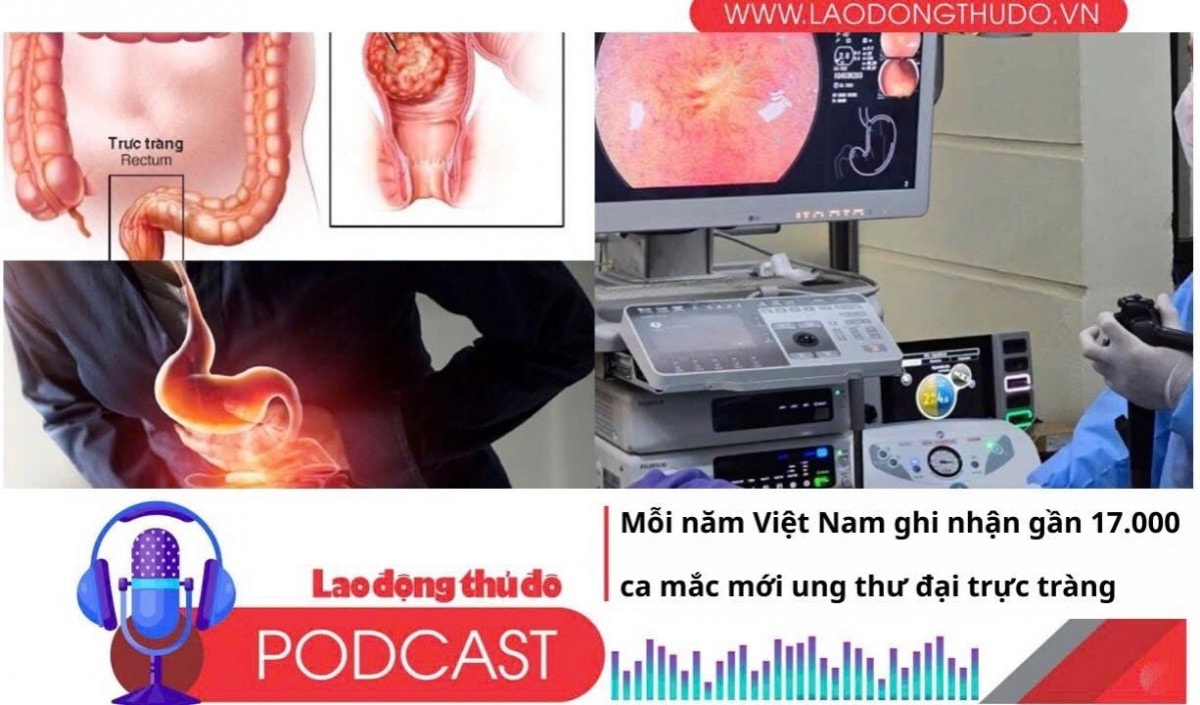 Điểm những tin nổi bật sáng ngày 13/4/2025: Mỗi năm Việt Nam ghi nhận gần 17.000 ca mắc mới ung thư đại trực tràng
