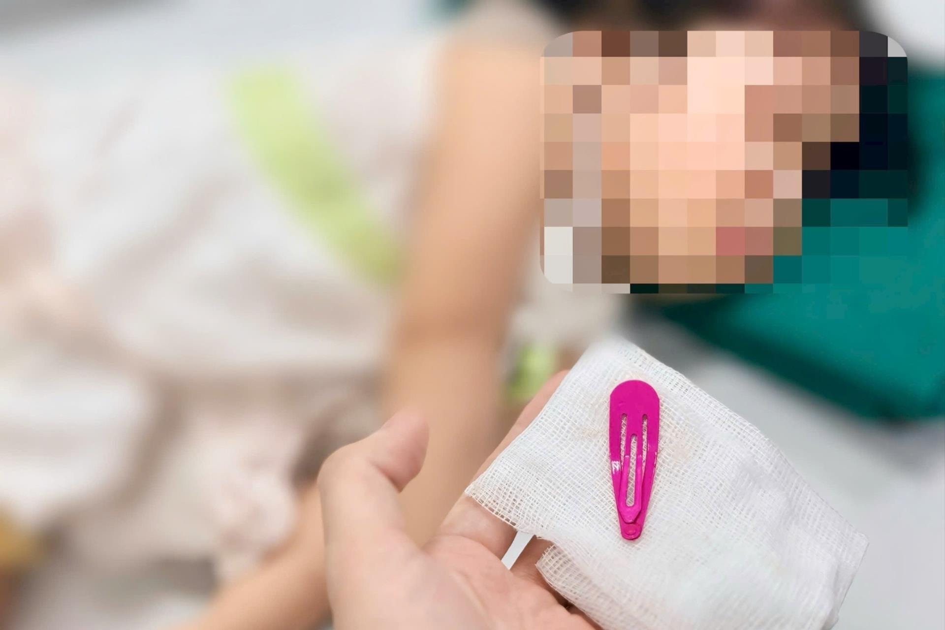 [Podcast] Bé gái nuốt kẹp tóc kim loại - Cảnh báo tai nạn “giấu mặt” cha mẹ cần biết