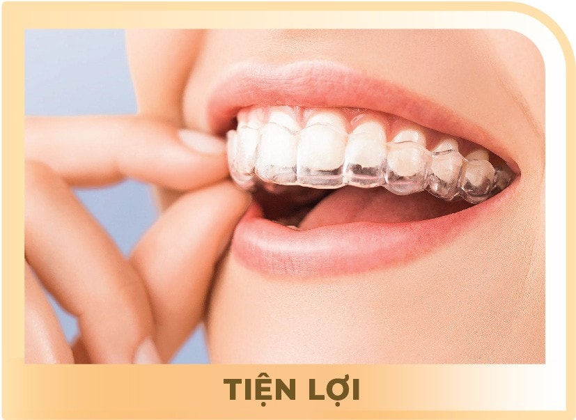 Niềng răng Invisalign không chỉ mang lại nụ cười đẹp mà còn giúp cải thiện sức khỏe răng miệng tổng thể.