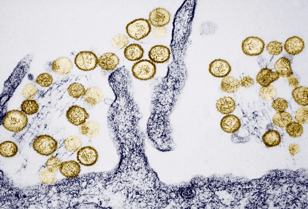virus-hanta-1.png