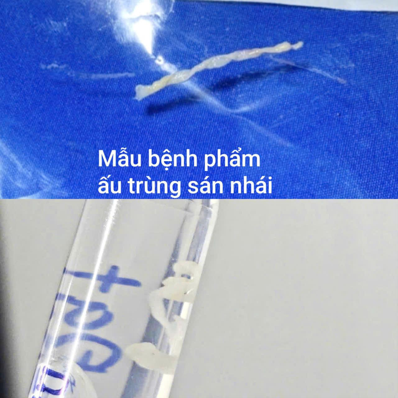 mau-benh-pham-au-trung-san-nhai.jpg