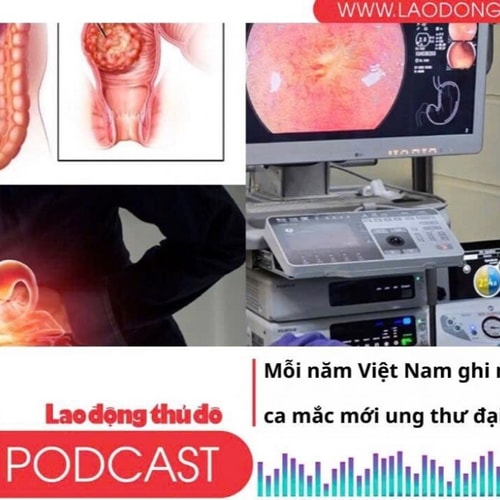 Điểm những tin nổi bật sáng ngày 13/4/2025: Mỗi năm Việt Nam ghi nhận gần 17.000 ca mắc mới ung thư đại trực tràng