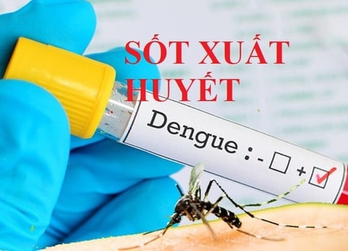 [Podcast] Tin tức ngày 24-7: Hà Nội quyết không để dịch sốt xuất huyết bùng phát