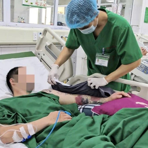 [Podcast] Sốt xuất huyết gây biến chứng hiếm gặp, nam thanh niên suýt mất tay