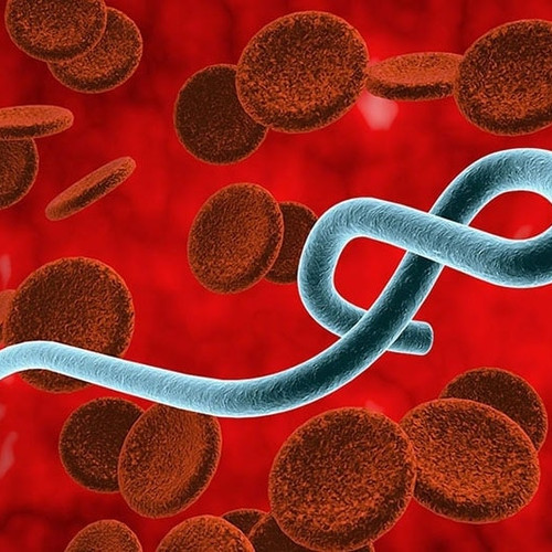 [Podcast] Tin tức ngày 24-5: Bộ Y tế chỉ đạo khẩn về phòng, chống dịch Ebola xâm nhập