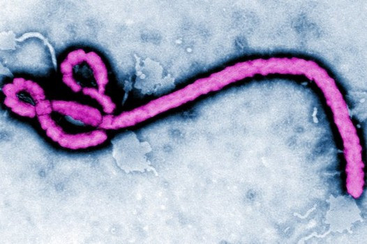 Virus gây dịch ở Congo không liên quan với virus Ebola tại Tây Phi
