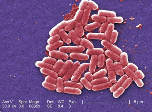 Siêu vi khuẩn kháng kháng sinh có thể giết chết 10 triệu người từ nay đến 2050