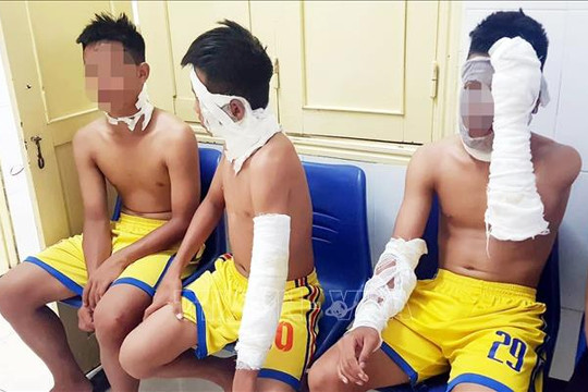 Chùm bóng bay phát nổ, ba cầu thủ Sông Lam Nghệ An nhập viện
