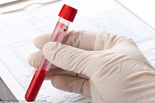Sẽ thí điểm xét nghiệm máu phát hiện sớm hơn 50 loại ung thư