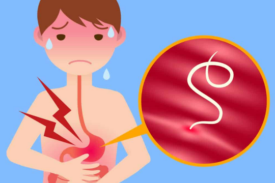 Cách nhận biết đau bụng giun