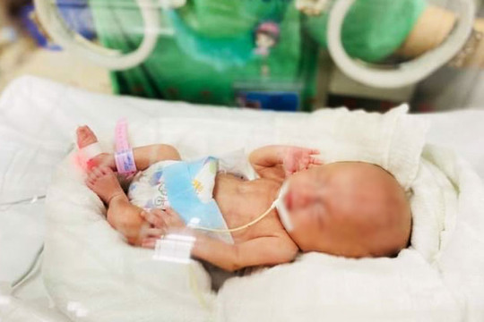Sự sống kỳ diệu của bé sinh non nhẹ cân nhất Việt Nam