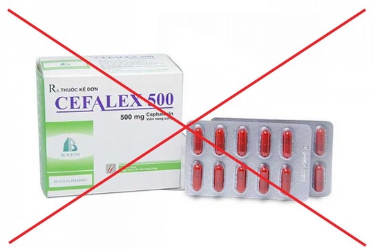 Cục Quản lý Dược (Bộ Y tế) Phát hiện lô thuốc giả Cephalexin 500 trên thị trường