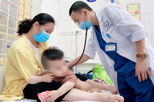 Hà Nội: Số ca mắc sốt xuất huyết giảm, tay chân miệng tăng