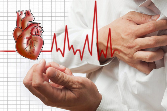 Dấu hiệu điển hình của cơn nhồi máu cơ tim