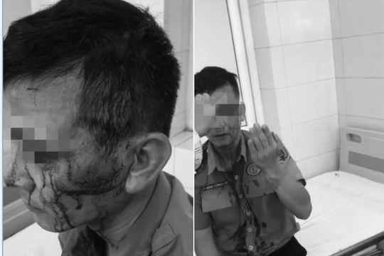 Công an “vào cuộc” vụ bảo vệ Bệnh viện K bị “cò bệnh viện” hành hung