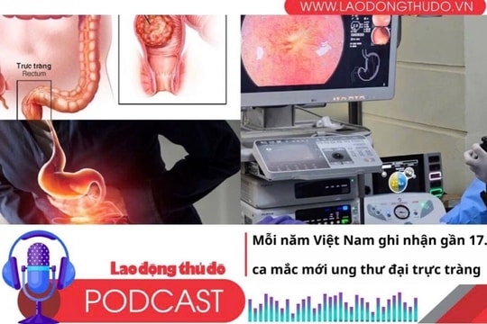 Điểm những tin nổi bật sáng ngày 13/4/2025: Mỗi năm Việt Nam ghi nhận gần 17.000 ca mắc mới ung thư đại trực tràng