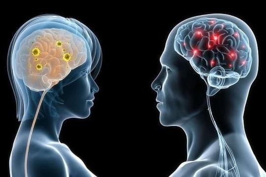 Những dấu hiệu thiếu máu não