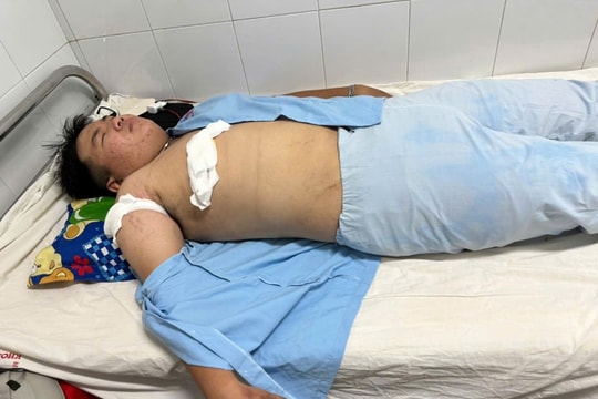 Bình Định: Nam thanh niên bị đâm trọng thương trên đường về nhà