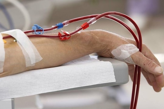 Cảnh giác với triệu chứng thận "kêu cứu"