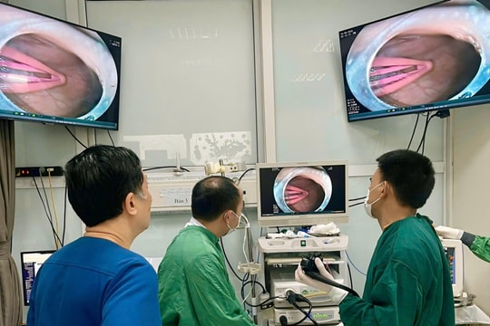 Gắp thành công kẹp tóc dài 5cm trong dạ dày bé gái 21 tháng tuổi