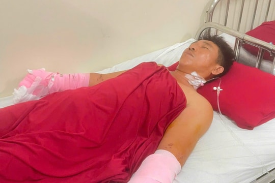 Huế: Người đàn ông đi câu cá bị điện giật nguy kịch