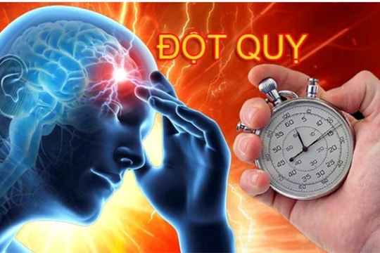 Giờ vàng cấp cứu đột quỵ