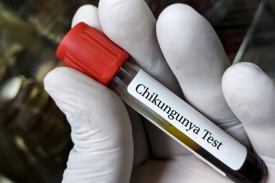 Bộ Y tế Tăng cường phòng, chống bệnh Chikungunya