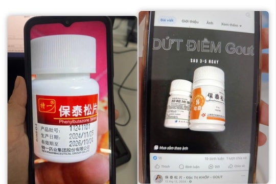 Dị ứng nặng vì tự ý dùng thuốc cấm phenylbutazone trị đau khớp
