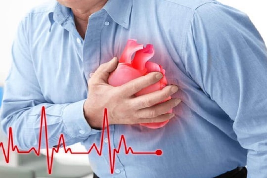 Bác sĩ tại nhà: Stress kéo dài có làm tăng nguy cơ tử vong do bệnh tim?