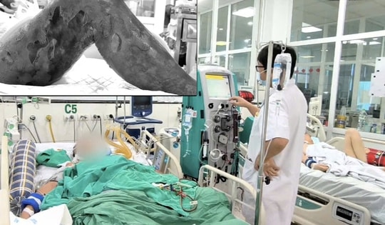 Người đàn ông nguy kịch chỉ từ một vết gai đâm vào đùi