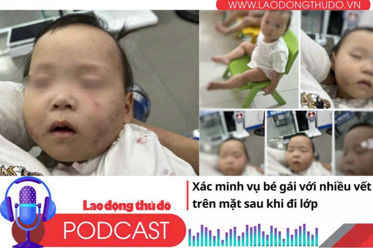 Điểm những tin nổi bật sáng ngày 5/9/2025: Xác minh vụ bé gái với nhiều vết bầm trên mặt sau khi đi lớp