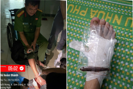 Quảng Ngãi Trưởng Công an xã bị thương nặng khi giúp dân chống lũ