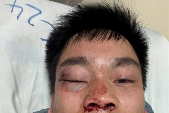 Người đi đường hành hung lái xe buýt số 67 Phùng – Kim Sơn