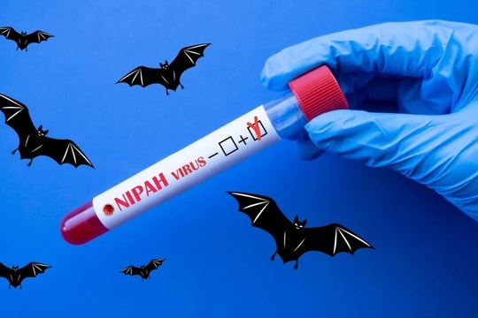 TP Hồ Chí Minh: Chưa phát hiện vi rút Nipah trong cộng đồng