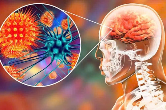 Cảnh báo khẩn: Tuyệt đối không ăn trái cây có dấu hiệu bị động vật cắn dở để phòng vi rút Nipah