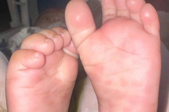 Khi xét nghiệm của bố mẹ cứu con khỏi căn bệnh thầm lặng