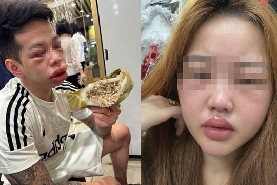 Bánh trứng kiến “hot trend” nhưng tiềm ẩn nguy cơ dị ứng