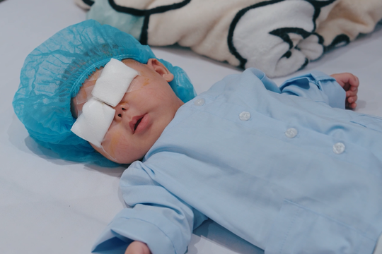 Giành lại ánh sáng cho bé sinh non mắc glôcôm bẩm sinh