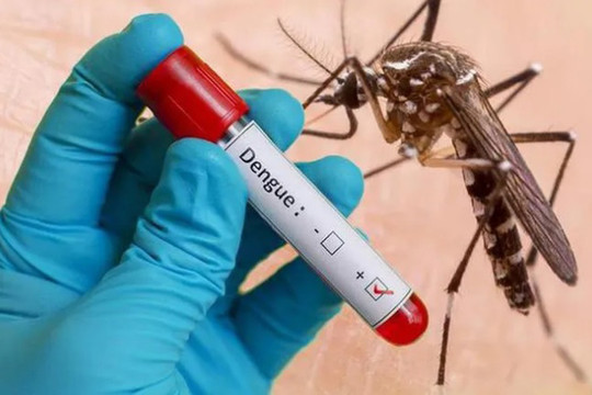 Sốt xuất huyết Dengue: Diễn biến khó lường, không theo quy luật cũ