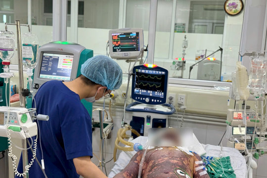 Liên tiếp 4 ca nhiễm liên cầu lợn nguy kịch