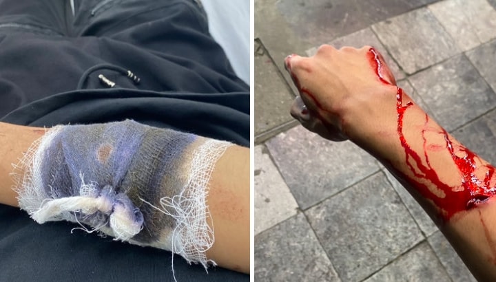 Hà Nội: Một thanh niên bị chém và cướp xe máy ngay trước Nhà hát Lớn