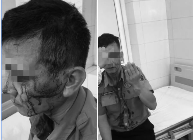 Công an “vào cuộc” vụ bảo vệ Bệnh viện K bị “cò bệnh viện” hành hung