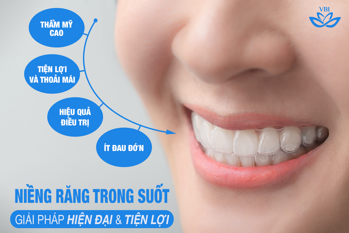 Niềng răng trong suốt tại Nha khoa Việt - Bỉ, giải pháp hiện đại cho nụ cười hoàn hảo