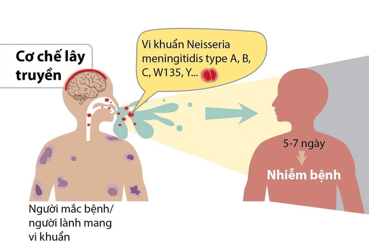 TP Hồ Chí Minh có 1 ca tử vong nghi nhiễm trùng do não mô cầu