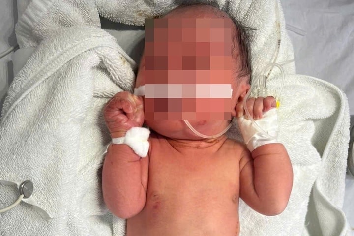 Hà Nội: Bé sơ sinh bị bỏ rơi tại bụi chuối bên sông, côn trùng đốt khắp người