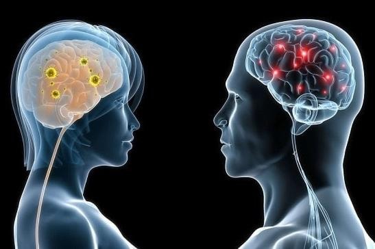 Những dấu hiệu thiếu máu não