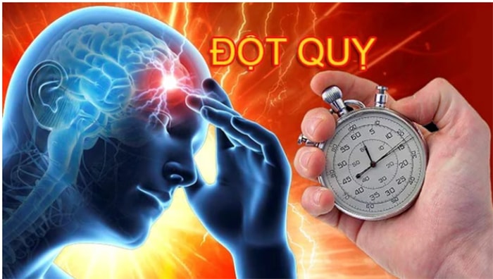Giờ vàng cấp cứu đột quỵ