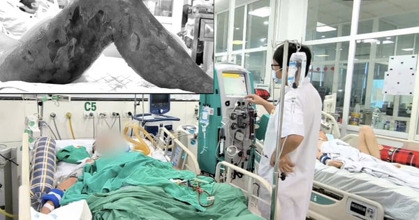 Người đàn ông nguy kịch chỉ từ một vết gai đâm vào đùi