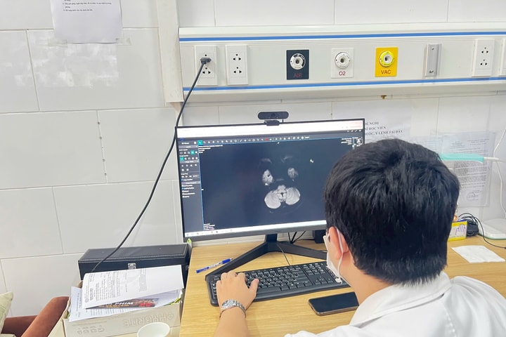 Thiếu niên 15 tuổi tổn thương não vì ngộ độc thuốc lá điện tử chứa ma túy